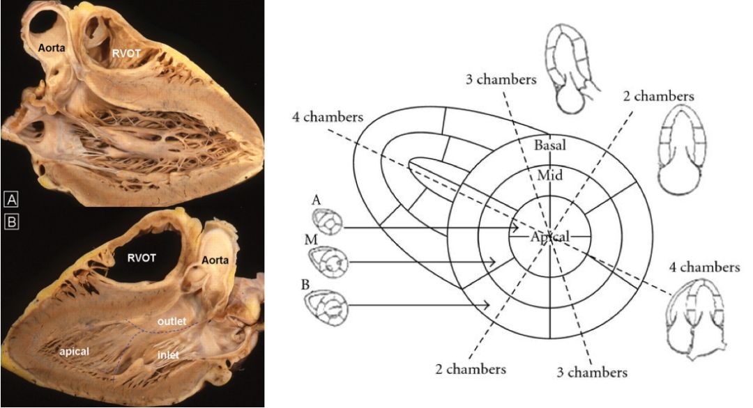 心电图mm单位怎么读12导、15导、18导连接示意图及心脏各壁超声解剖位置与心电图导联对应关系_https://www.jmylbn.com_新闻资讯_第18张
