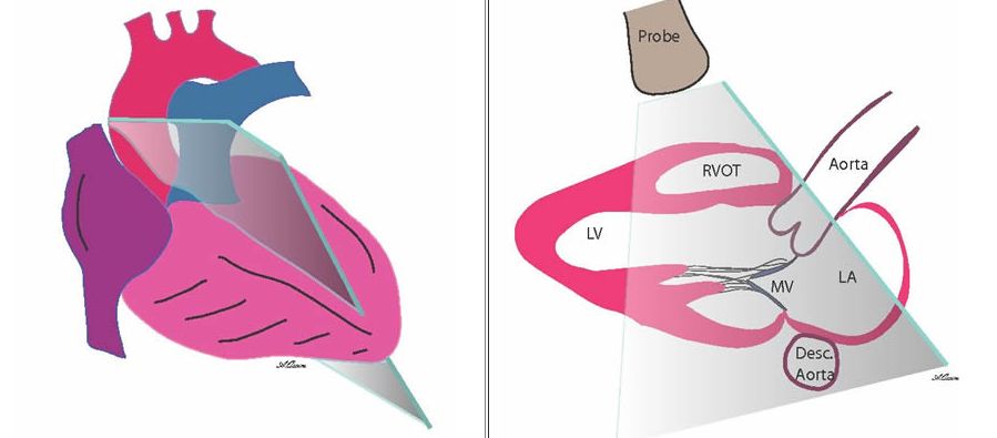 心电图mm单位怎么读12导、15导、18导连接示意图及心脏各壁超声解剖位置与心电图导联对应关系_https://www.jmylbn.com_新闻资讯_第17张