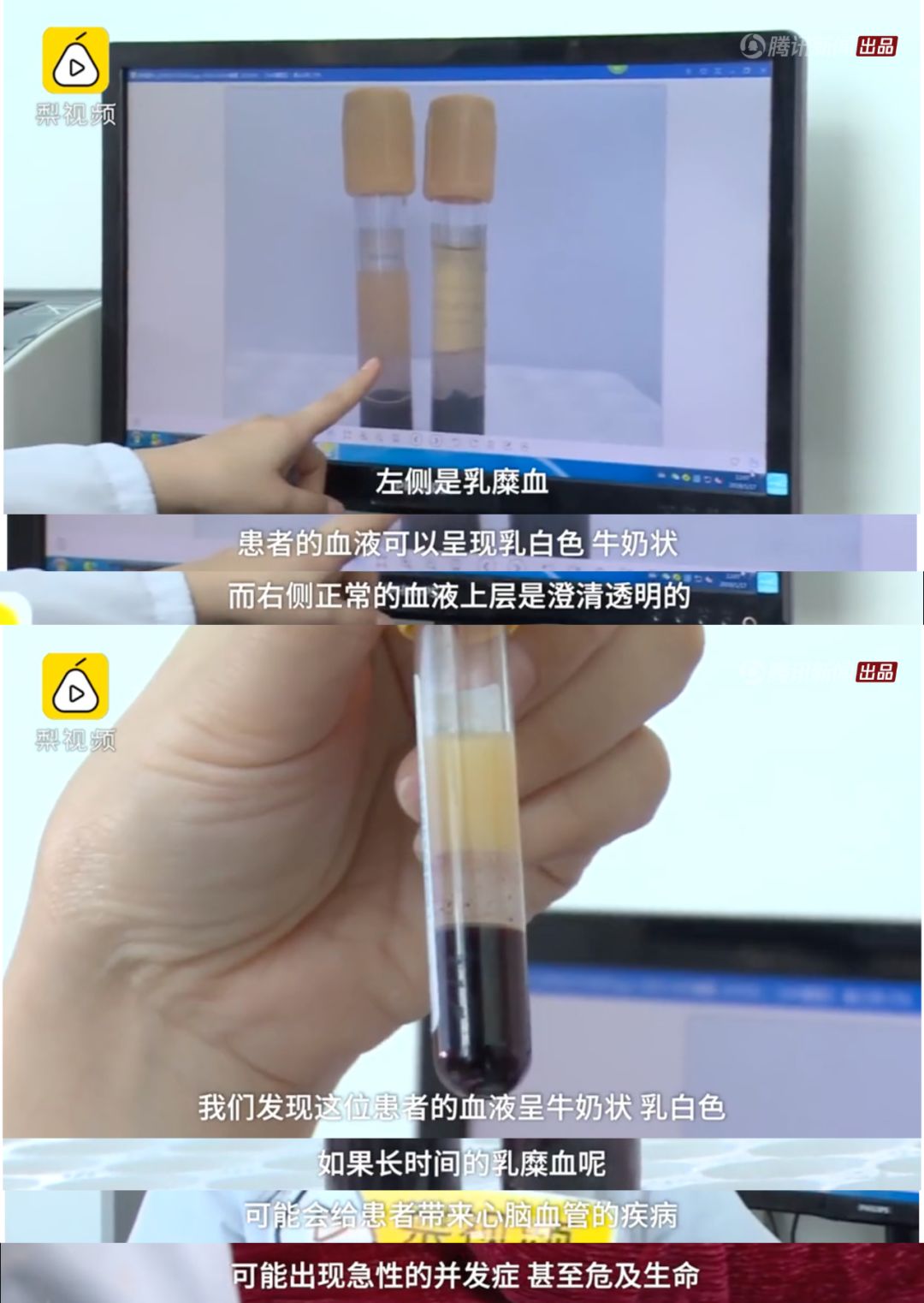 女子吃外卖4个月，爆瘦40斤，背后的原因细思极恐.....