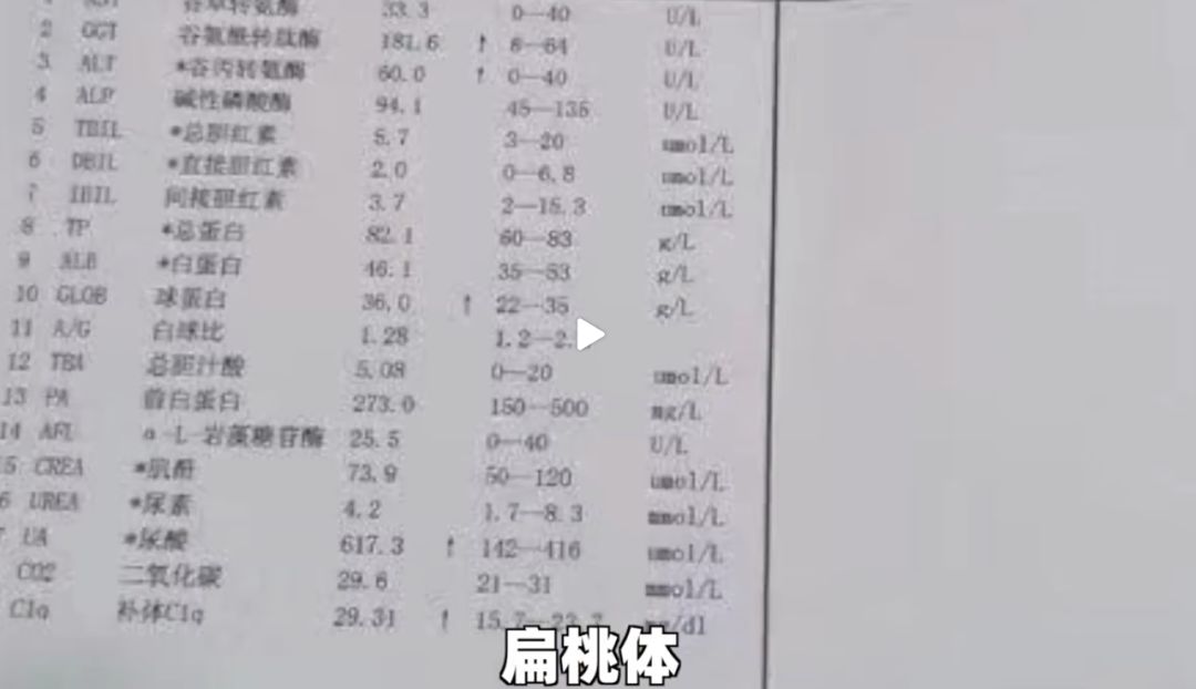 21歲大學生患糖尿病：縱欲，正在毀掉你的生活 健康 第9張