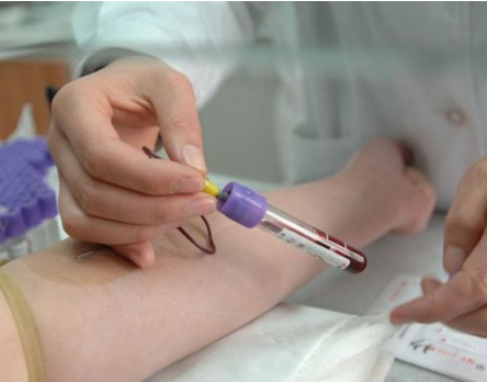 胎儿可以采取脐血亲子鉴定