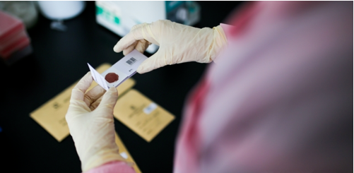 親子鑒定大概多少錢,需要哪些手續(xù)？