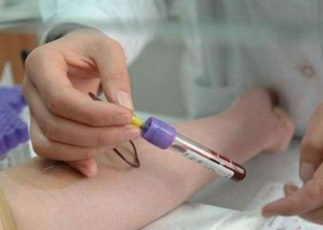 做胎儿无创dna鉴定需要什么？看着里！