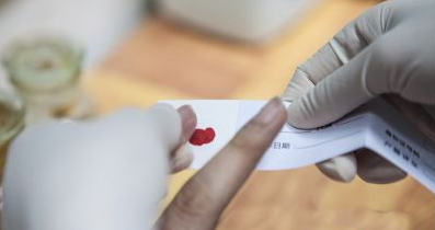 司法亲子鉴定血痕样本采集流程