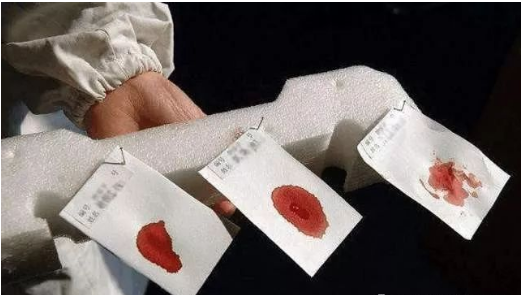司法亲子鉴定之血痕样本采集方式支招