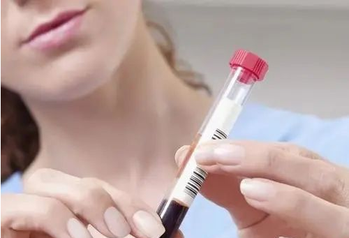 胎儿能不能做亲子鉴定呢？看着里！