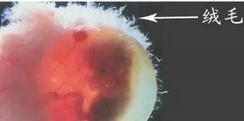 东莞能做胎儿亲子鉴定机构