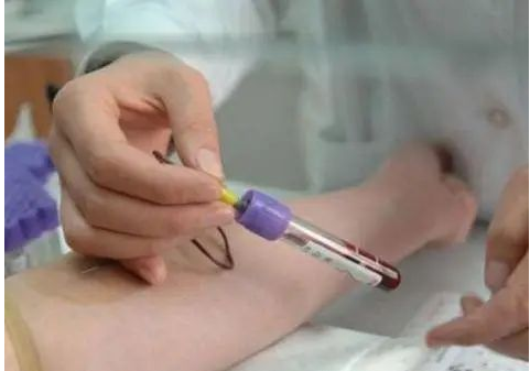 亲子鉴定的特殊样本都有哪些？看这里！