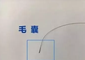 毛发做亲子鉴定准确吗？看着里!