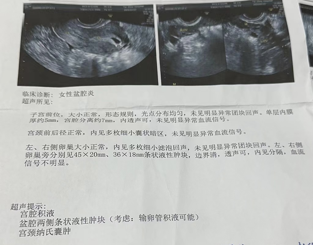 妇科磁疗怎么用的困扰女性的妇科疾病，可以考虑磁疗~_https://www.jmylbn.com_新闻资讯_第2张