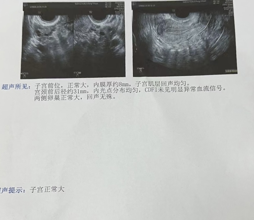 妇科磁疗怎么用的困扰女性的妇科疾病，可以考虑磁疗~_https://www.jmylbn.com_新闻资讯_第3张