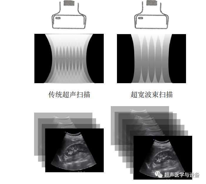 siui彩超怎么用第84届CMEF超声厂家“群英会”---汕头超声：中国超声行业的“老大哥”_https://www.jmylbn.com_新闻资讯_第27张
