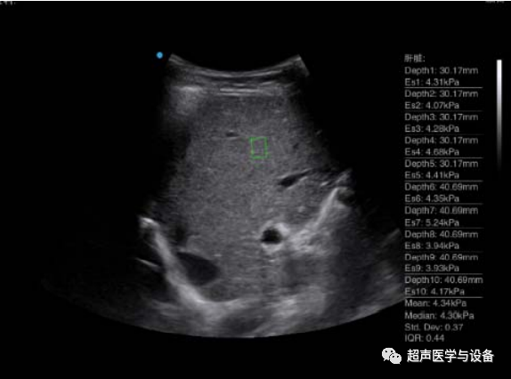 siui彩超怎么用第84届CMEF超声厂家“群英会”---汕头超声：中国超声行业的“老大哥”_https://www.jmylbn.com_新闻资讯_第38张