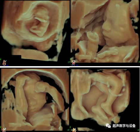 siui彩超怎么用第84届CMEF超声厂家“群英会”---汕头超声：中国超声行业的“老大哥”_https://www.jmylbn.com_新闻资讯_第40张