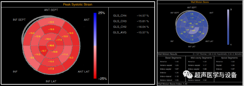 siui彩超怎么用第84届CMEF超声厂家“群英会”---汕头超声：中国超声行业的“老大哥”_https://www.jmylbn.com_新闻资讯_第43张