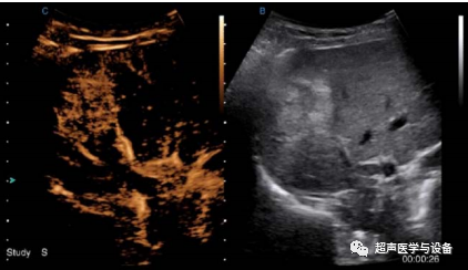 siui彩超怎么用第84届CMEF超声厂家“群英会”---汕头超声：中国超声行业的“老大哥”_https://www.jmylbn.com_新闻资讯_第45张