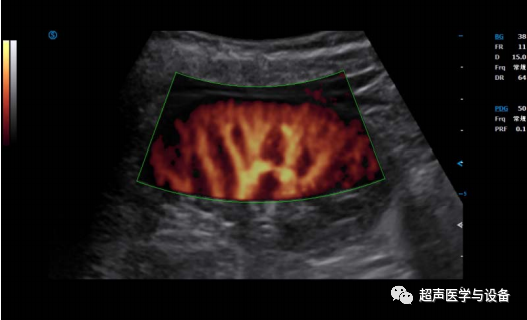 siui彩超怎么用第84届CMEF超声厂家“群英会”---汕头超声：中国超声行业的“老大哥”_https://www.jmylbn.com_新闻资讯_第36张