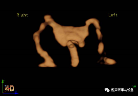 siui彩超怎么用第84届CMEF超声厂家“群英会”---汕头超声：中国超声行业的“老大哥”_https://www.jmylbn.com_新闻资讯_第46张