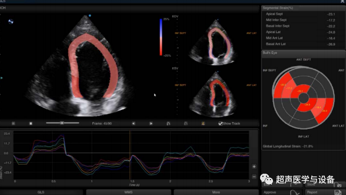siui彩超怎么用第84届CMEF超声厂家“群英会”---汕头超声：中国超声行业的“老大哥”_https://www.jmylbn.com_新闻资讯_第42张