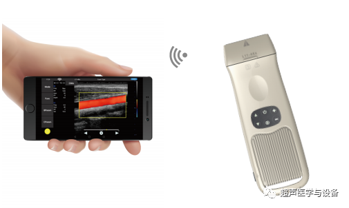 索诺星超声怎么样【一文盘点】市场主流掌上超声_https://www.jmylbn.com_新闻资讯_第24张