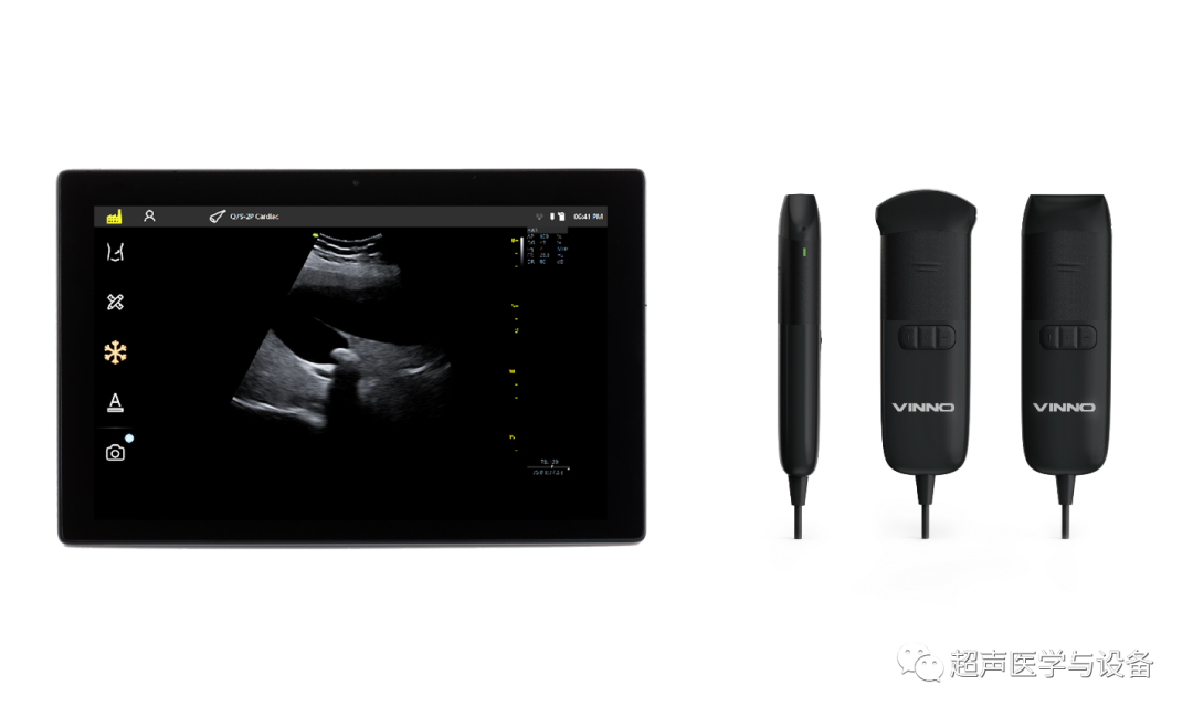 索诺星超声怎么样【一文盘点】市场主流掌上超声_https://www.jmylbn.com_新闻资讯_第19张