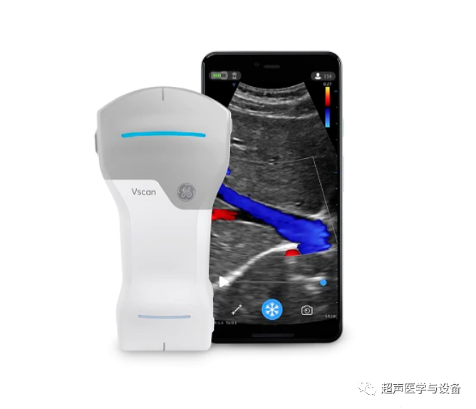 索诺星超声怎么样【一文盘点】市场主流掌上超声_https://www.jmylbn.com_新闻资讯_第13张