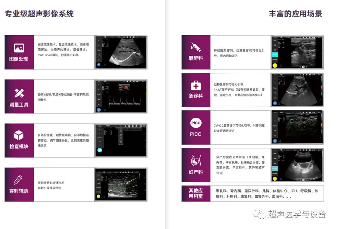 索诺星超声怎么样【一文盘点】市场主流掌上超声_https://www.jmylbn.com_新闻资讯_第25张
