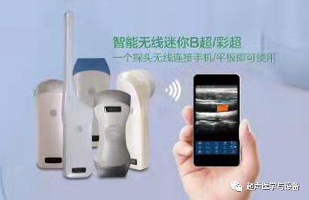索诺星超声怎么样【一文盘点】市场主流掌上超声_https://www.jmylbn.com_新闻资讯_第27张