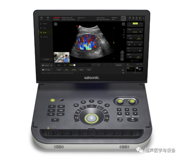 华声医疗 怎么样第84届CMEF超声厂家“八仙过海”---华声医疗：“新超声”-另辟蹊径的Wise man_https://www.jmylbn.com_新闻资讯_第13张