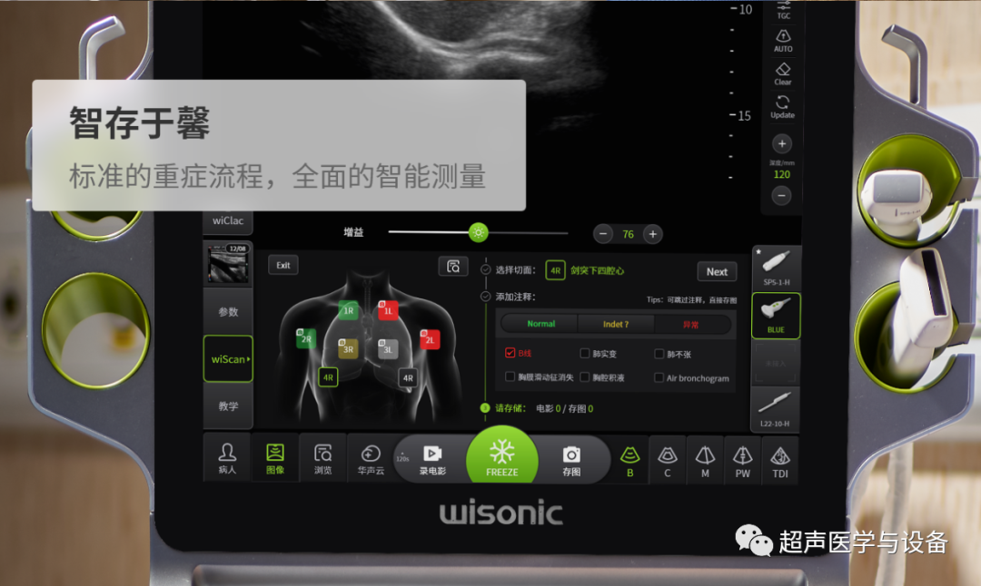 华声医疗 怎么样第84届CMEF超声厂家“八仙过海”---华声医疗：“新超声”-另辟蹊径的Wise man_https://www.jmylbn.com_新闻资讯_第24张