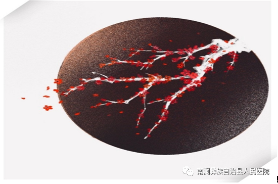 vsd是什么材料VSD负压吸引-上海聚慕医疗器械有限公司