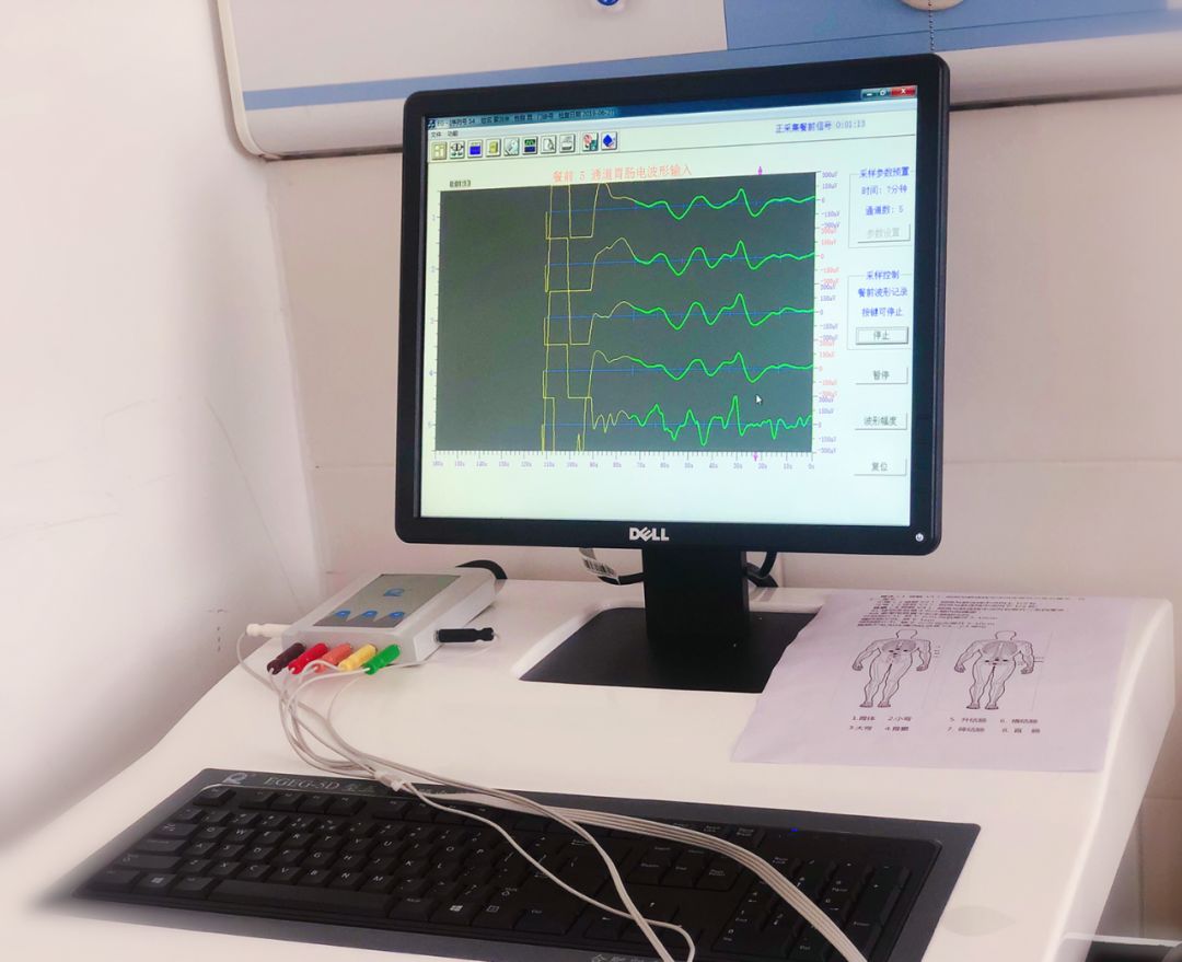 肠电图能查看什么烟台首台“胃肠电图”检测仪 ｜ 胃肠检查更轻松_https://www.jmylbn.com_新闻资讯_第8张