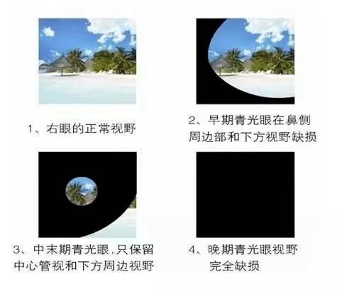 45岁以上,频繁更换老花镜仍旧感觉配不合适5. 虹视6.