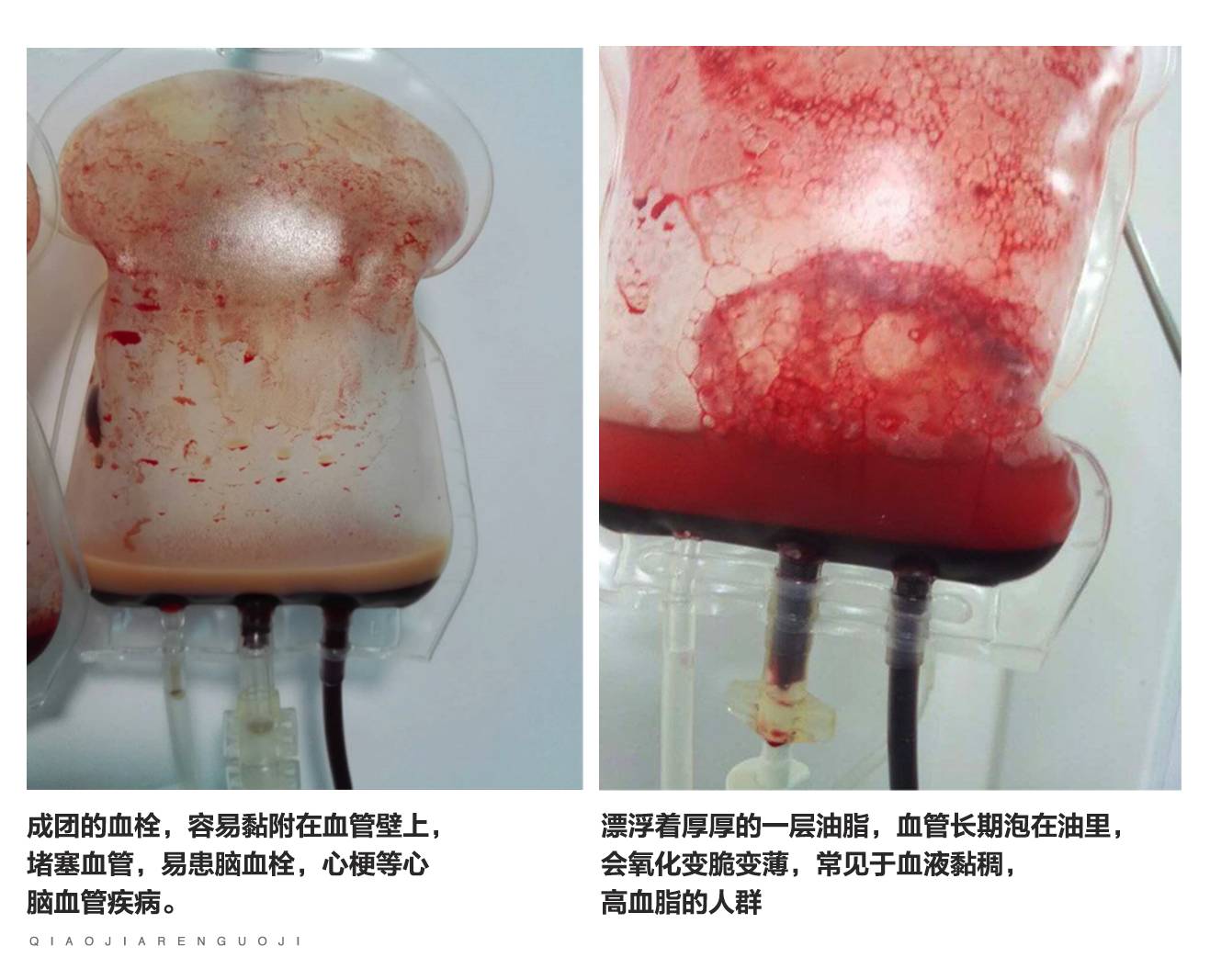 血液细胞活化前后对比