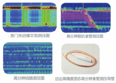消化道动力检测怎么做消化道动力疾病诊断新视界｜ 蚌埠三院高分辨率消化道动力检测投入使用_https://www.jmylbn.com_新闻资讯_第5张