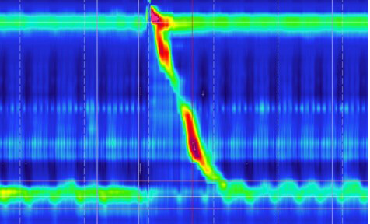 消化道动力检测怎么做消化道动力疾病诊断新视界｜ 蚌埠三院高分辨率消化道动力检测投入使用_https://www.jmylbn.com_新闻资讯_第9张