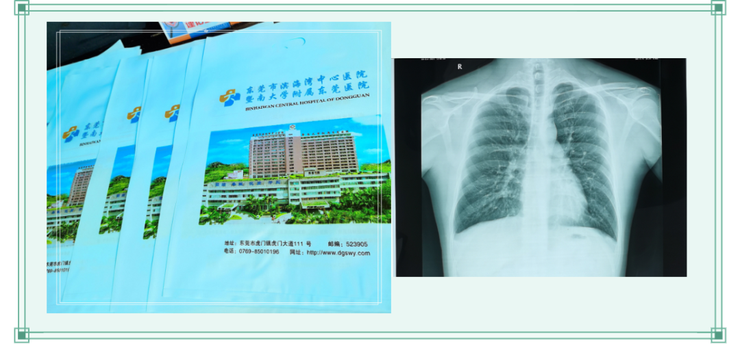 医学胶片怎么做医院【我为群众办实事】有了“云胶片”，看诊更方便！_https://www.jmylbn.com_新闻资讯_第2张