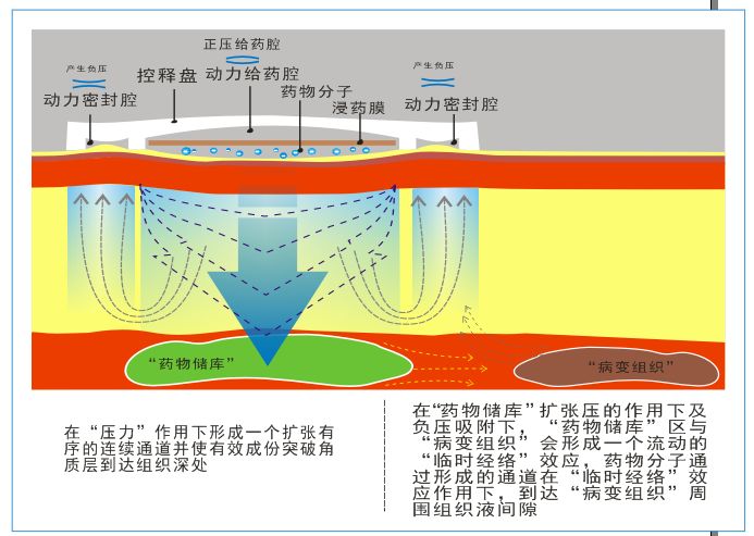 什么皮给药治全球突破性的中医给药技术“新汉方TTS ”技术介绍_https://www.jmylbn.com_新闻资讯_第15张