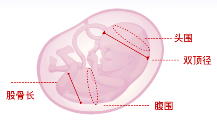 眼科ab超单怎么看产检B超单怎么看？还有浙大妇院“四步触诊”全攻略来啦！_https://www.jmylbn.com_新闻资讯_第5张