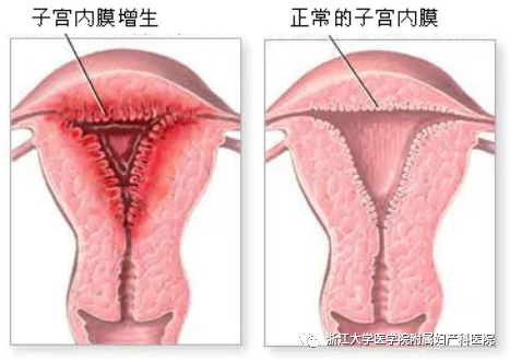 宫腔镜器械怎么安装小宫腔，大世界，且看宫腔镜如何发挥大功效_https://www.jmylbn.com_新闻资讯_第9张