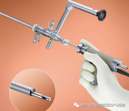 宫腔镜器械怎么安装小宫腔，大世界，且看宫腔镜如何发挥大功效_https://www.jmylbn.com_新闻资讯_第6张