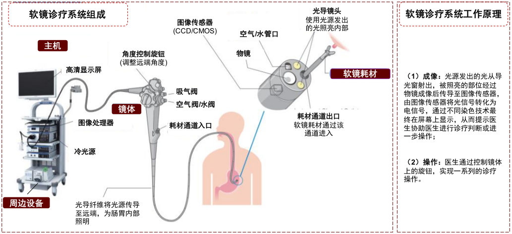 什么是软式内镜镜【产业解读】医用内窥镜及其市场简析_https://www.jmylbn.com_新闻资讯_第5张