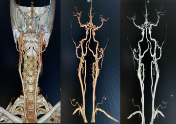 放射科怎么打印走进“神秘”的放射科小屋！_https://www.jmylbn.com_新闻资讯_第22张
