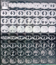 放射科怎么打印走进“神秘”的放射科小屋！_https://www.jmylbn.com_新闻资讯_第24张