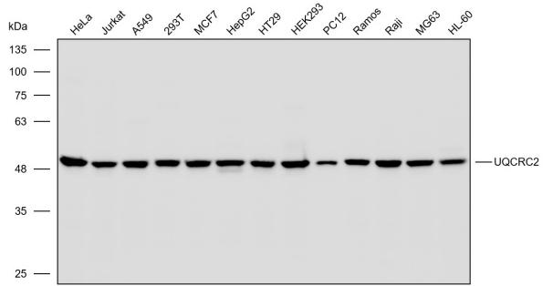 抗体产品星推荐第二十六期|Anti-UQCRC2 Polyclonal Antibody