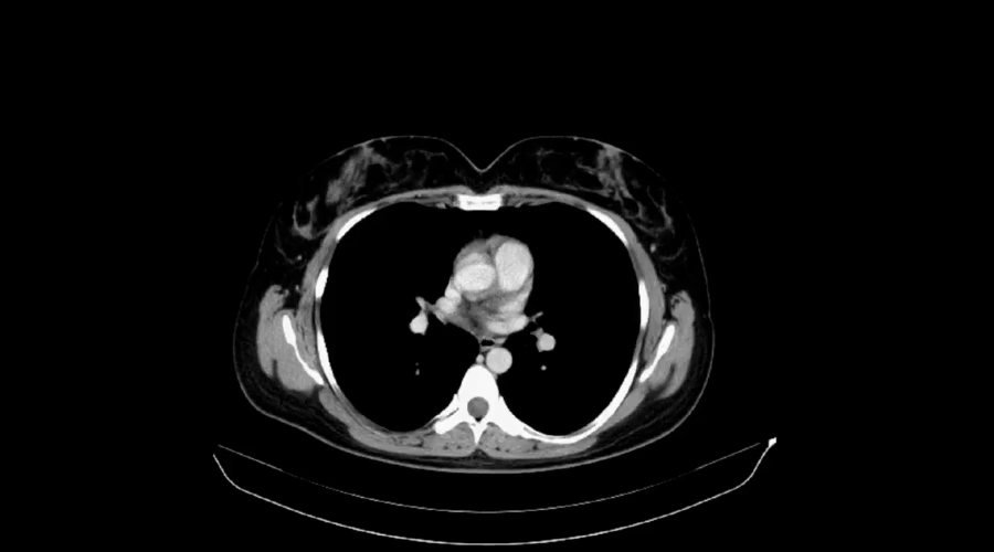 体检dr是什么意思体检单上的 DR、CT、MR，到底有啥区别？_https://www.jmylbn.com_新闻资讯_第7张