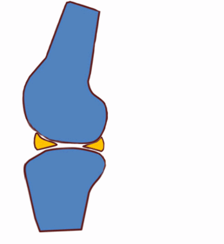 干货：高清动图学前交叉韧带MRI诊断，经典珍藏版！