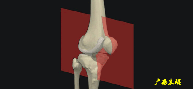 干货：高清动图学前交叉韧带MRI诊断，经典珍藏版！