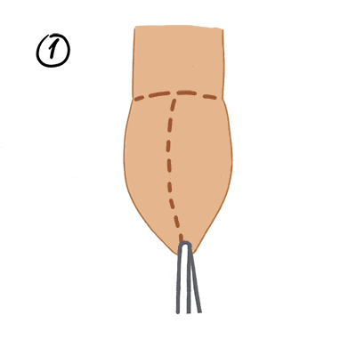 手术备皮包怎么使用【西昌割包皮手术多少钱】备皮、脱裤裤，揭秘割包皮全过程....._https://www.jmylbn.com_新闻资讯_第4张