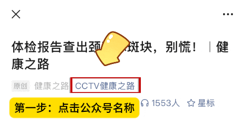 弹力腰围怎么用自测静脉曲张风险，再不重视就晚了！｜健康之路_https://www.jmylbn.com_新闻资讯_第2张